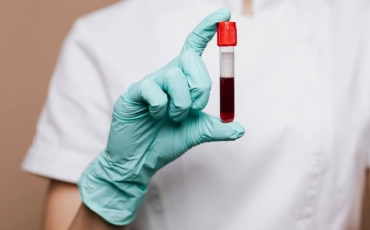 Conheça os exames que compõem o hepatograma!