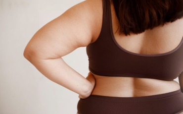 Lipedema: conheça os sintomas e tratamento desta doença crônica.