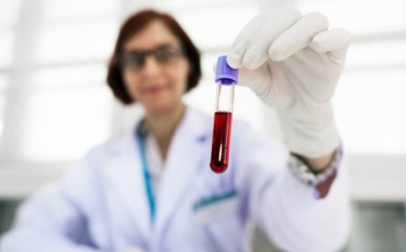 O que é o exame HLA-B27 e para que serve?