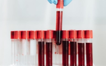 Saiba quais são as principais doenças hematológicas!