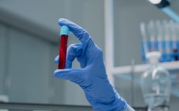 Você já ouviu falar em Púrpura Trombocitopênica Idiopática?