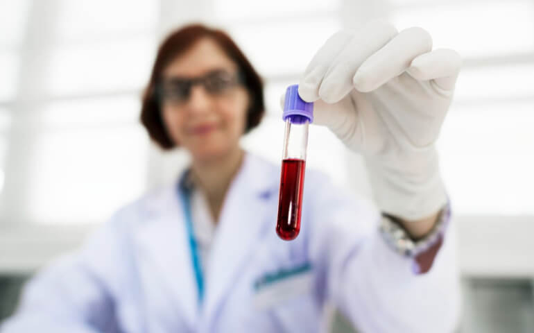 Junho Laranja: no mês de conscientização sobre anemia e leucemia, saiba como cuidar da saúde do sangue